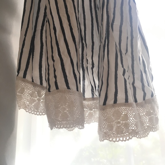 NEW Abercrombie Kids Blue and White Lace Dress - Picture 3 of 6