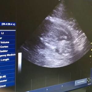 Meet your Posher, Quentin