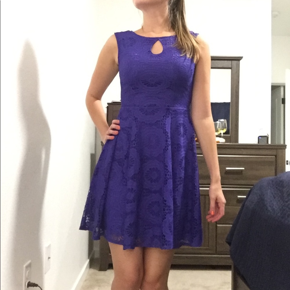 Lace Detail Midi Dress 👗 Worn Once