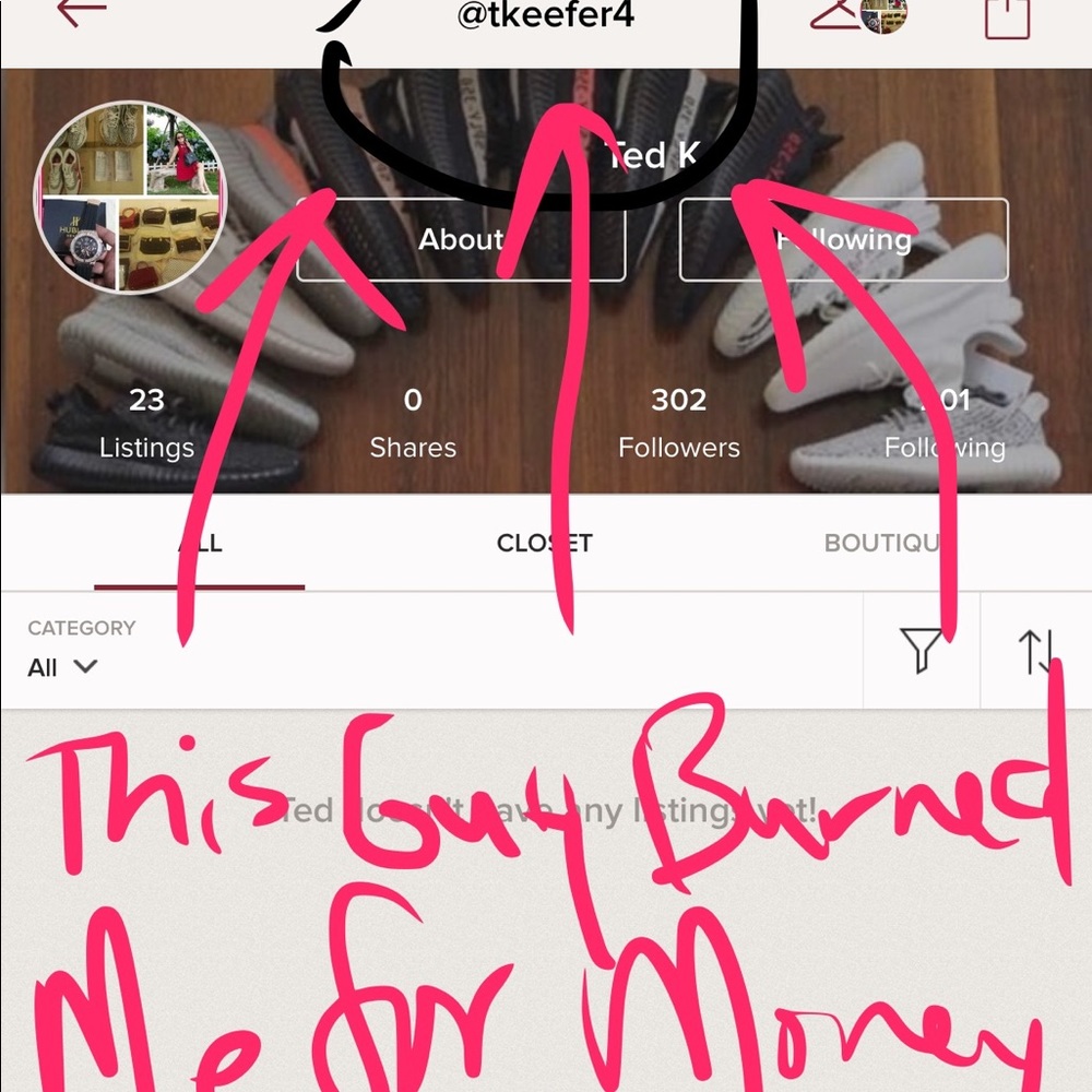 THIS GUY BURNED ME..!!