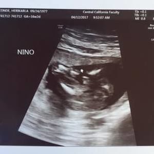 Meet your Posher, Hery karla