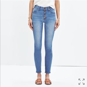 Madewell Skinny Crop Jeans: Button Through Edition