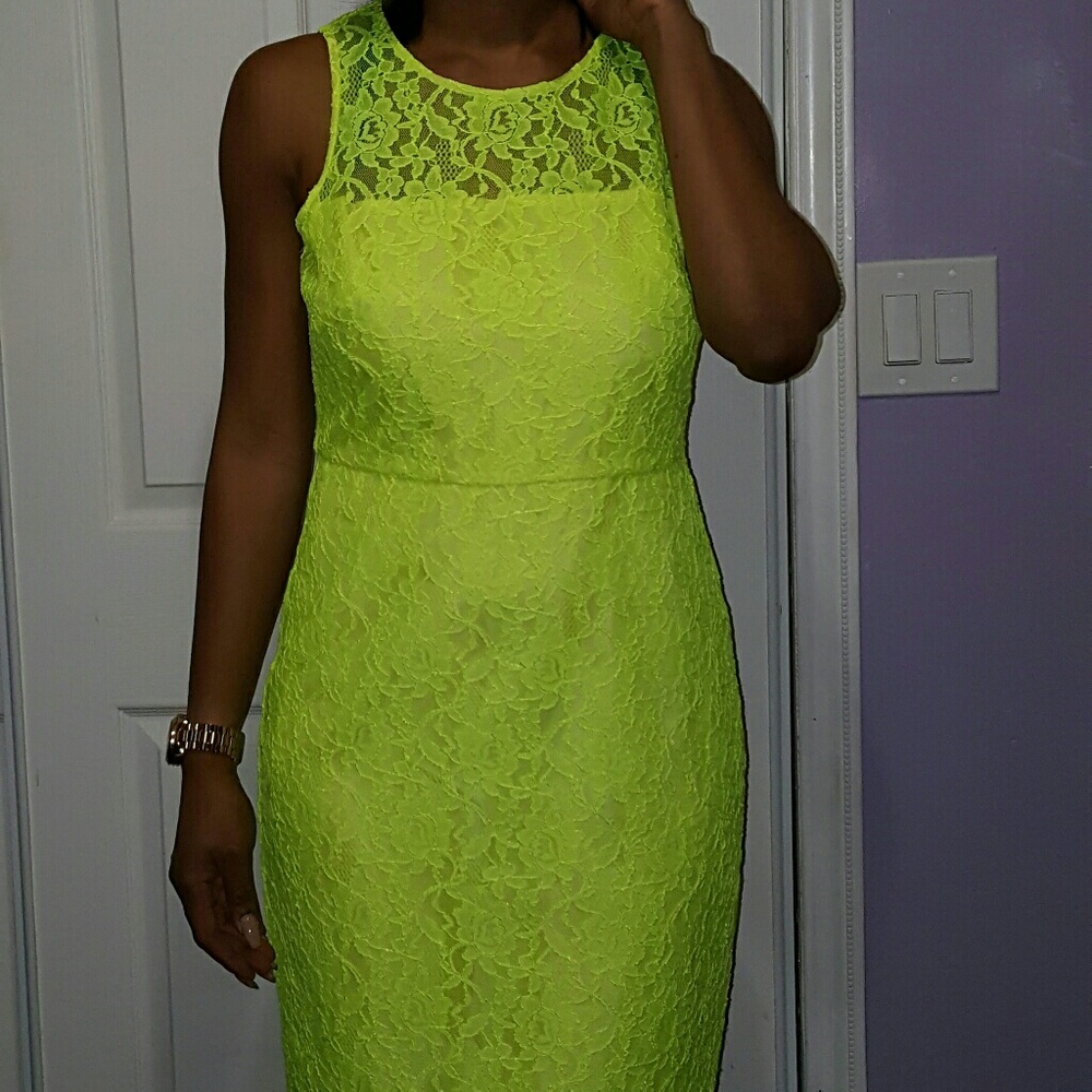 Stunning lace dress!