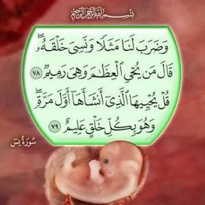 Meet your Posher, Ezedin