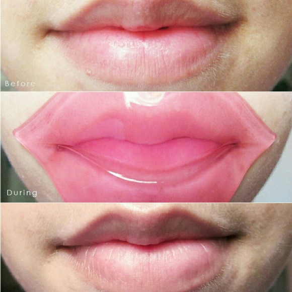 Tonymoly Hydrogel Lippatch I Private Offer Bundles - Picture 5 of 5