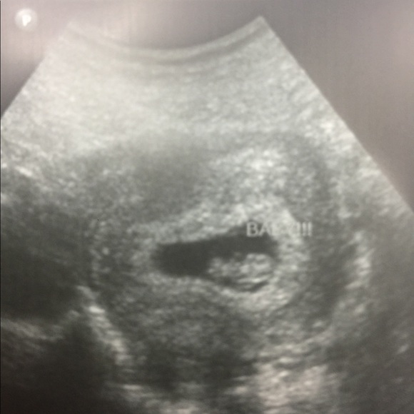 We're Pregnant! 🤰🏼👶🏼😍 - Picture 2 of 6