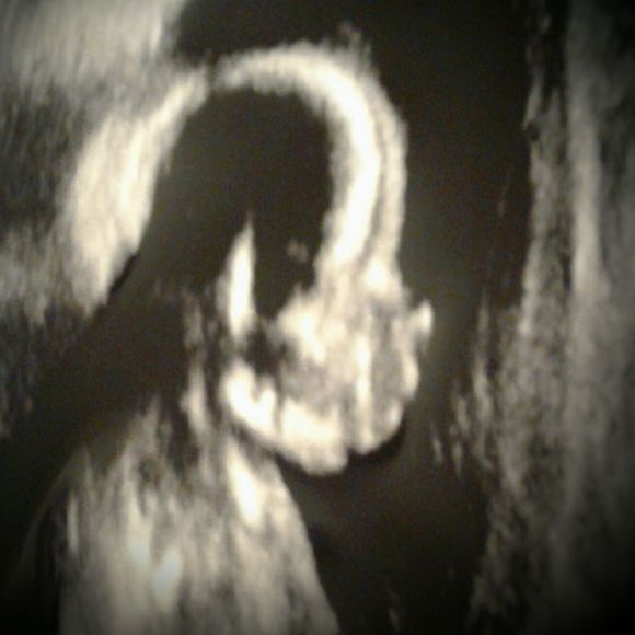 Meet your Posher, Cardenas - Picture 1 of 1