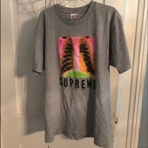 Supreme x-ray tee