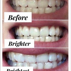Whitening toothpaste
