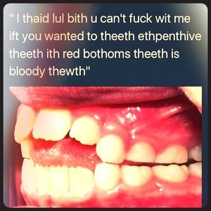 Meet your Posher, Brenee