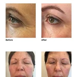 arbonne eye cream for dark circles