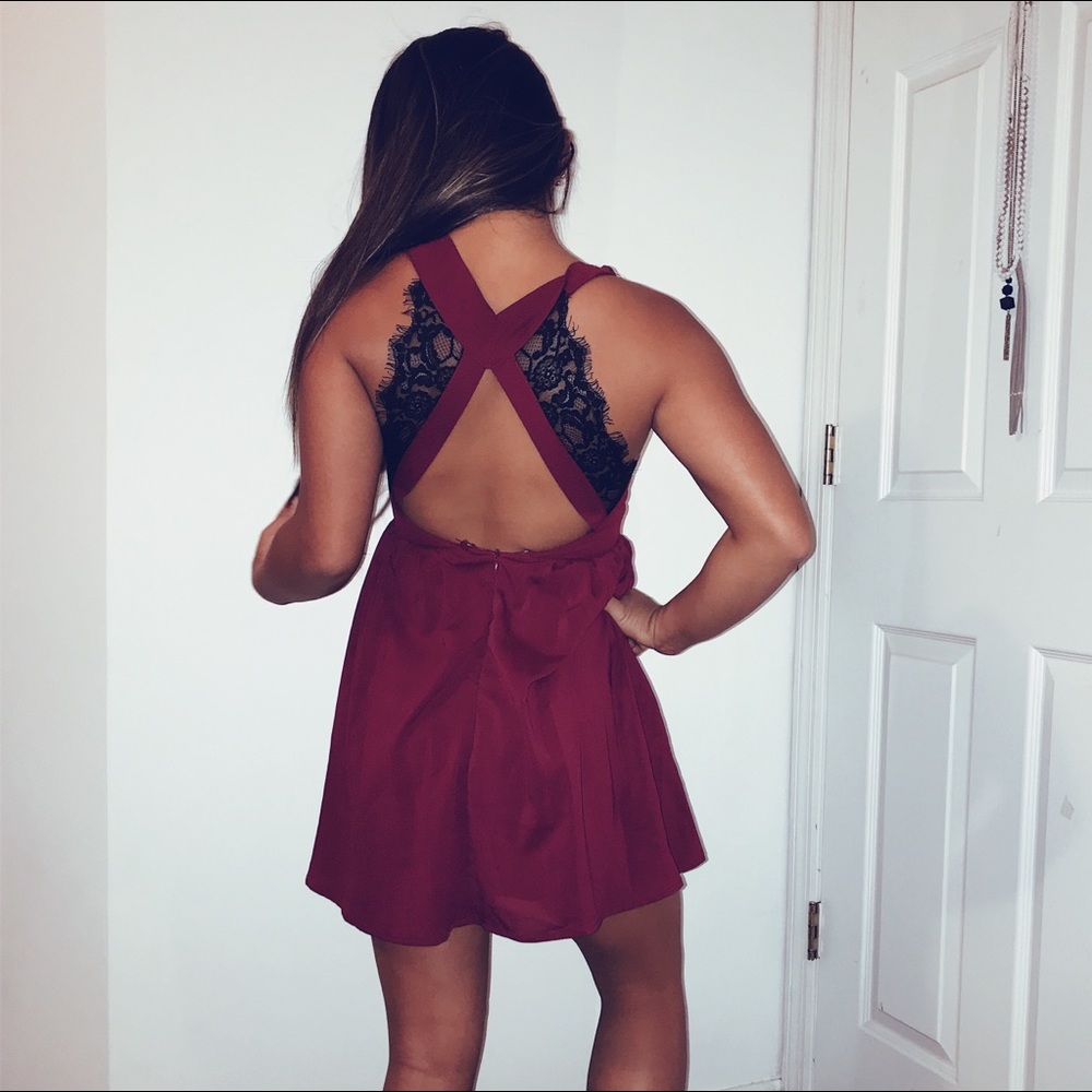 tobi lace dress