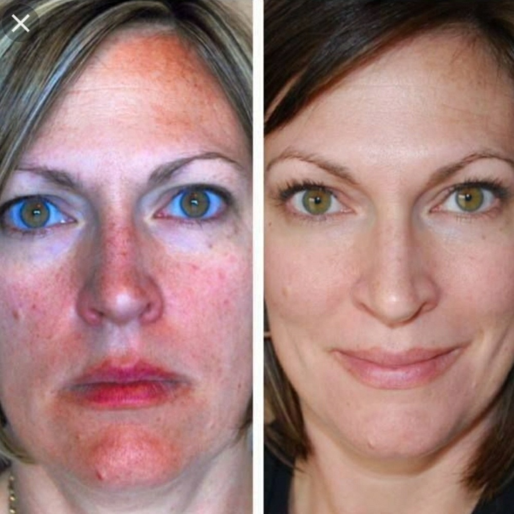 Rodan and Fields Skin care system - Picture 3 of 8