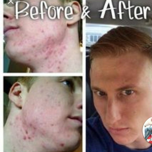 Rodan and Fields Skin care system - Picture 5 of 8