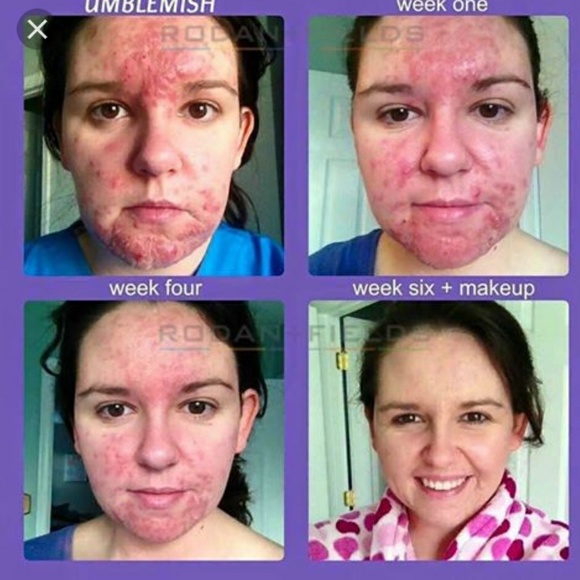 Rodan and Fields Skin care system - Picture 6 of 8