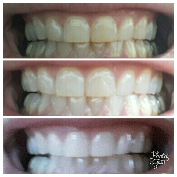 Whitening Toothpaste - Picture 2 of 2