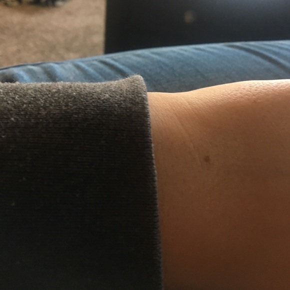 Vintage freckle on hand - Picture 1 of 1
