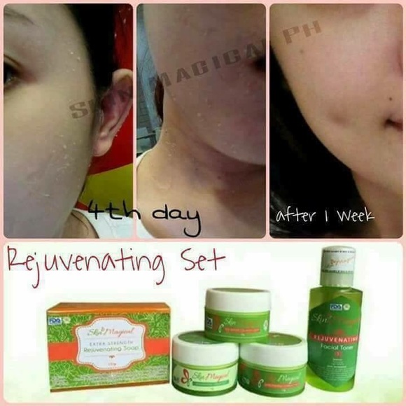 Skin Magical Rejuvenating Set Kit # 1 - Picture 2 of 8