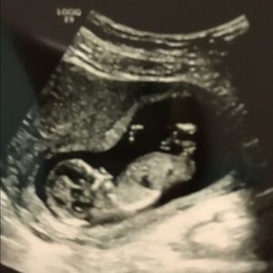 Meet your Posher, Daniela