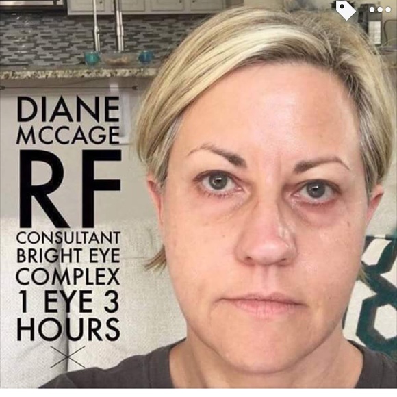 Rodan + Fields Active Hydration Bright Eye Complex - Picture 4 of 5