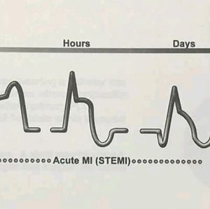 Meet your Posher, Kc