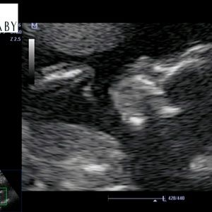 Meet your Posher, Fabiola