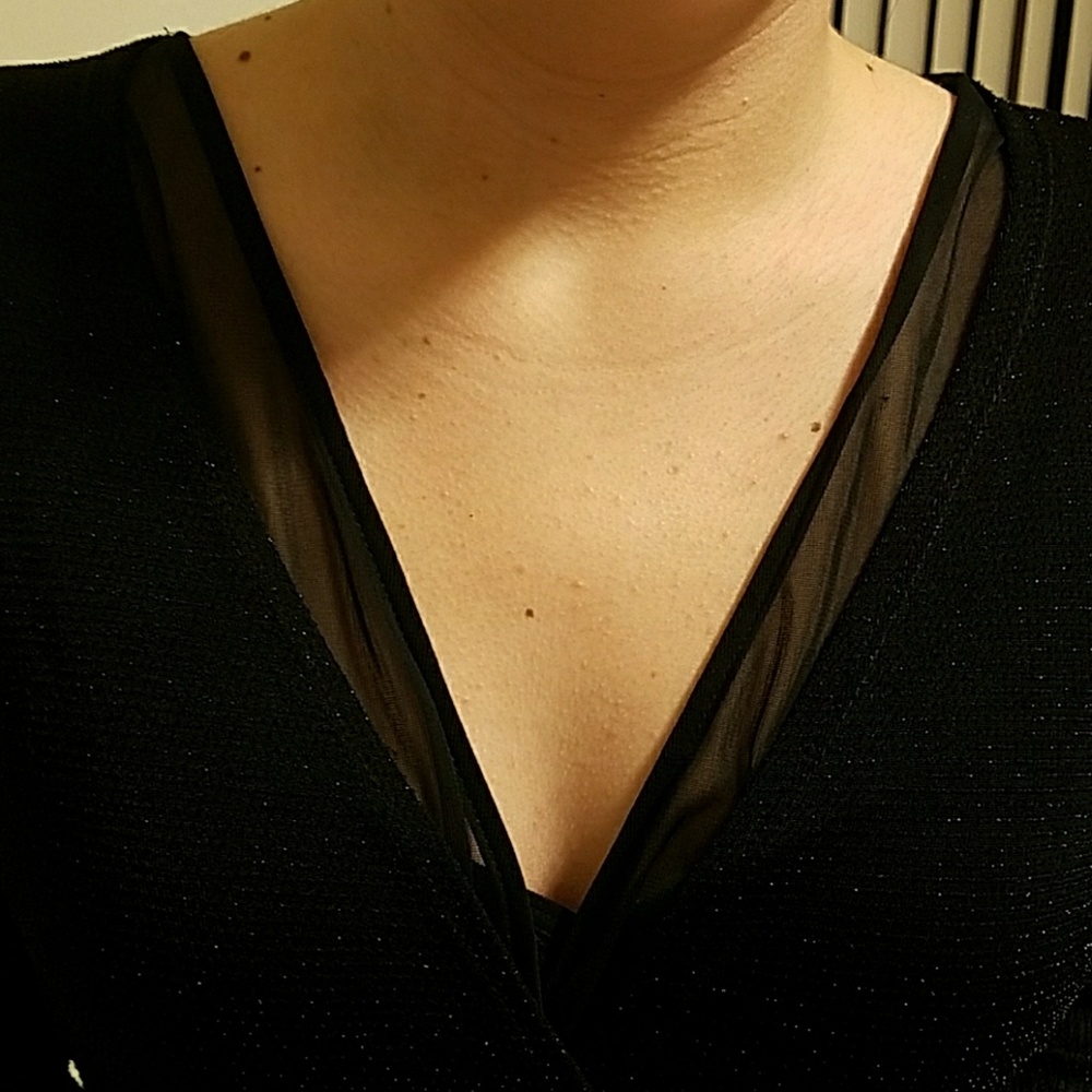 EXPRESS ROMPER - Picture 3 of 4
