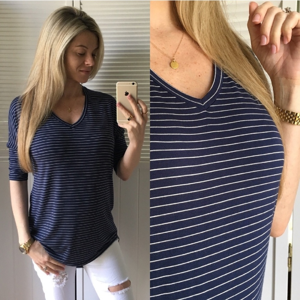 Blue and White Striped Top