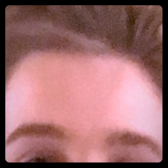 My friends hairline