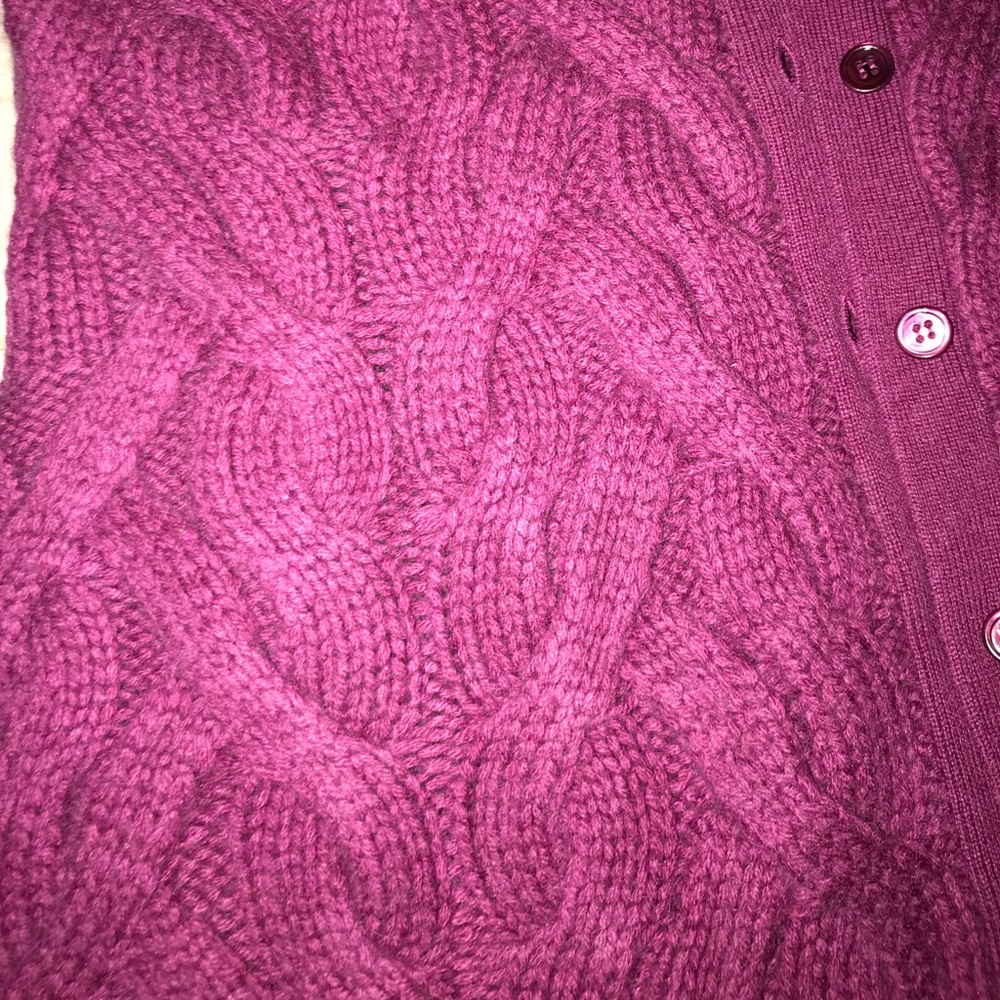 Button down jacket - Picture 3 of 6