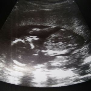 Meet your Posher, Teri