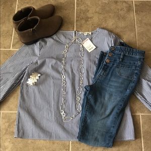 Blue and White Striped Tunic