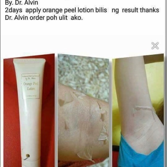 Dr. Alvi. PSCF Orange Peeling Soap Lotion - Picture 3 of 8