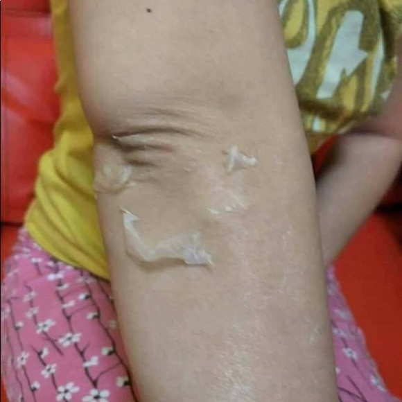 Dr. Alvi. PSCF Orange Peeling Soap Lotion - Picture 5 of 8