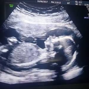 Meet your Posher, Andi