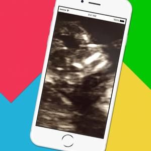 Meet your Posher, Jonathandiana