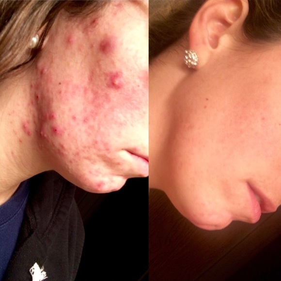 Skin care - Picture 2 of 4