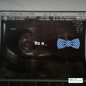 Meet your Posher, Flor