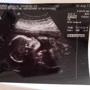 Meet your Posher, Hairo magali de