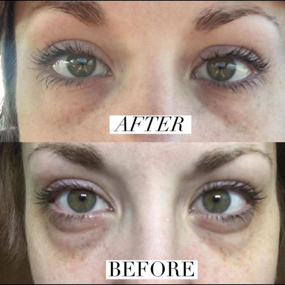 NERIUM - Picture 4 of 8