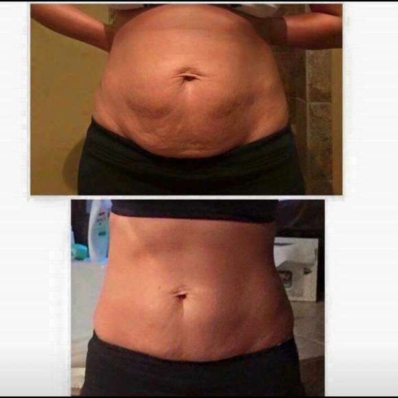 NERIUM - Picture 7 of 8