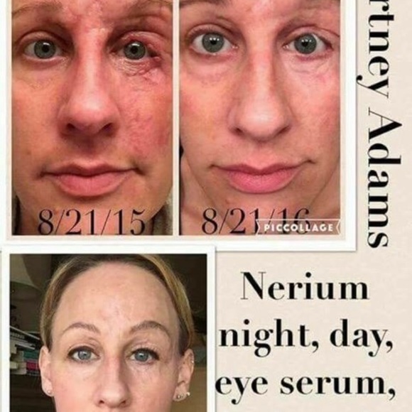 NERIUM - Picture 8 of 8