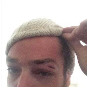 Meet your Posher, Patrick