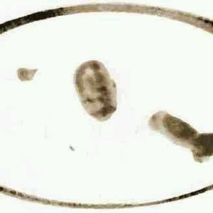 Meet your Posher, Douglas