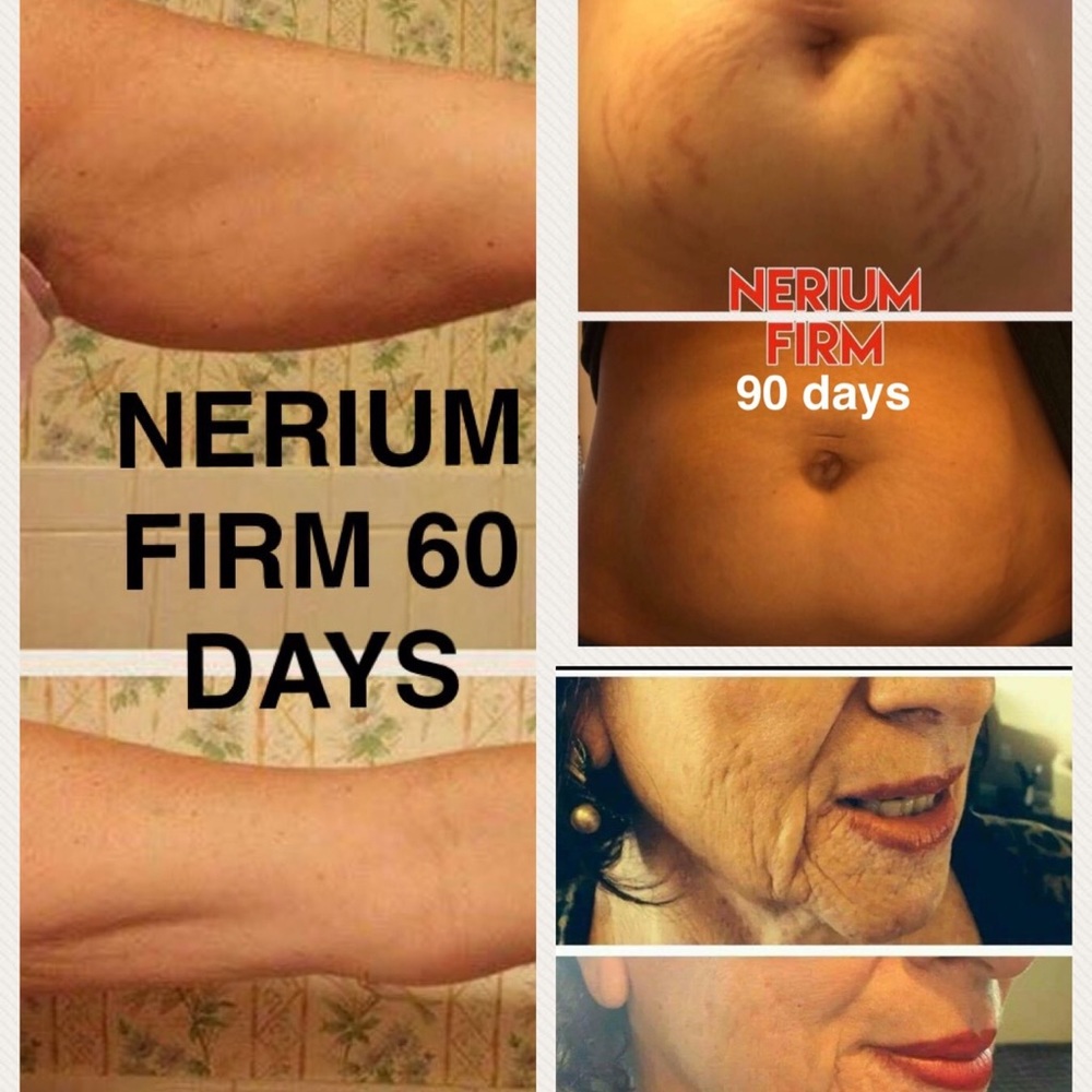 NERIUM