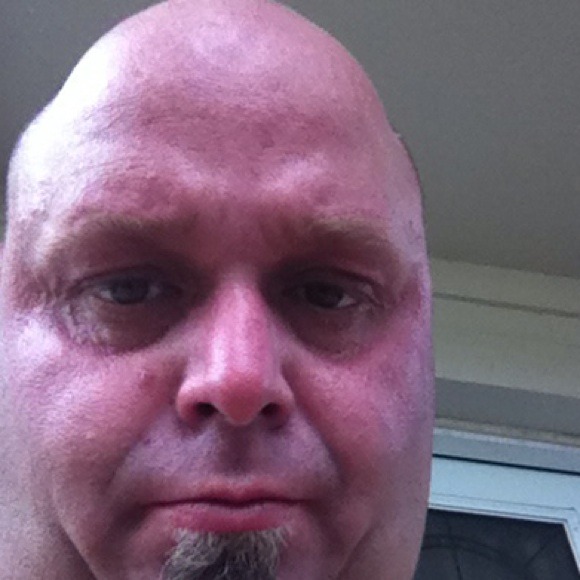 lumpy75