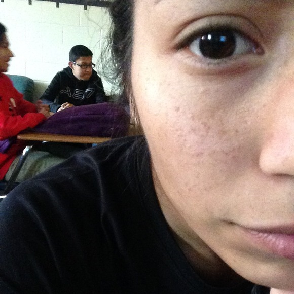 anelis1
