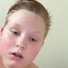 sslski
