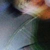 lida_boutis