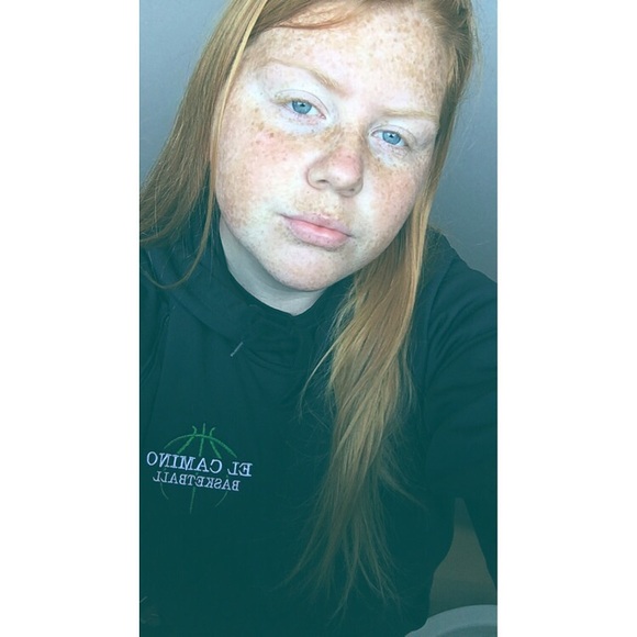 kileeyy_1